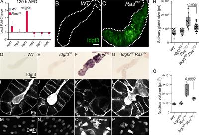 Chitinase-like proteins promoting tumorigenesis through disruption of cell polarity via enlarged endosomal vesicles